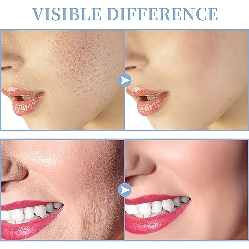 Portable Handheld High Frequency Facial Machine with 4 Tubes Y375840