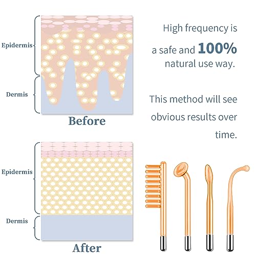 Portable Handheld High Frequency Facial Machine with 4 Tubes Y375840