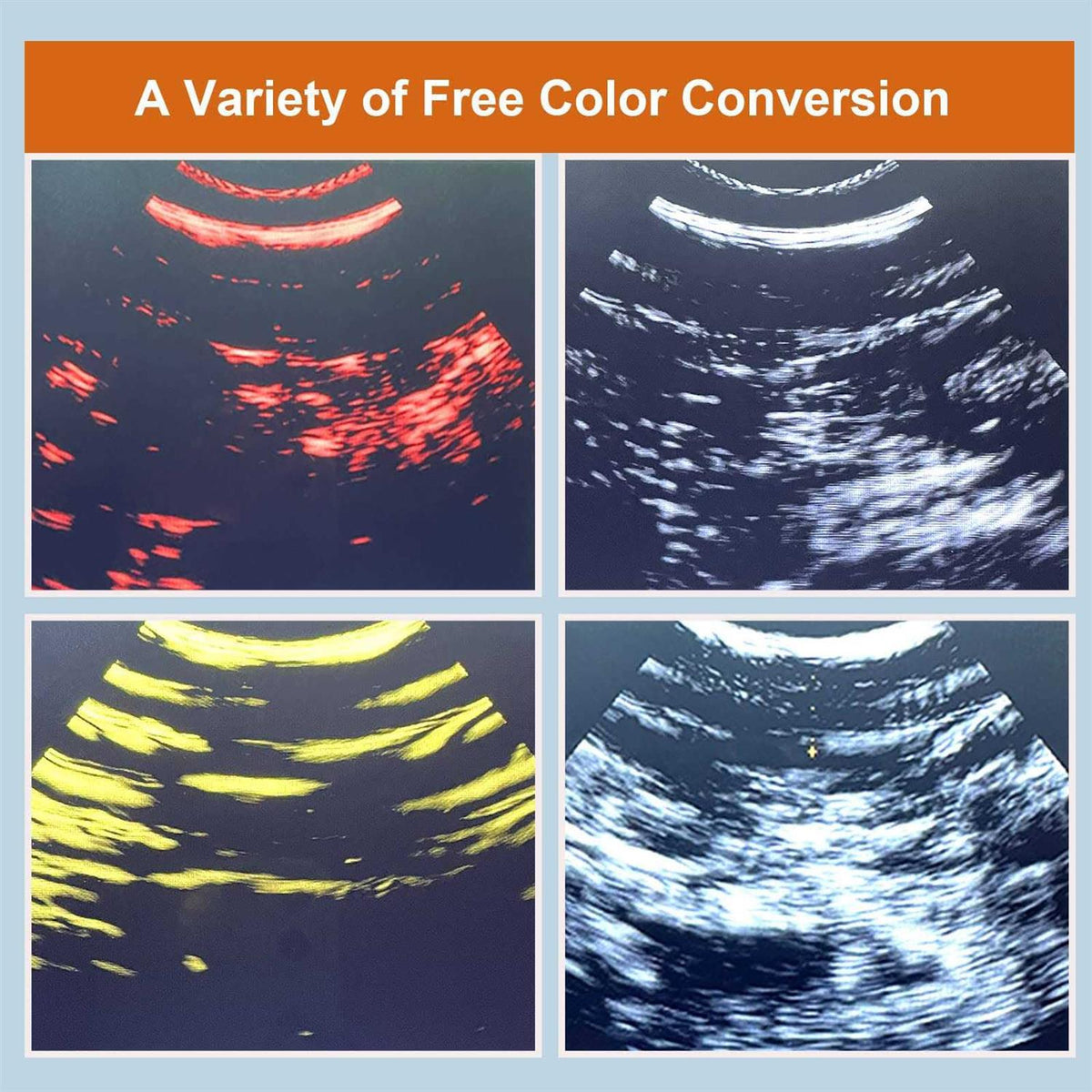 Wireless Portable Veterinary Ultrasound Scanner R205